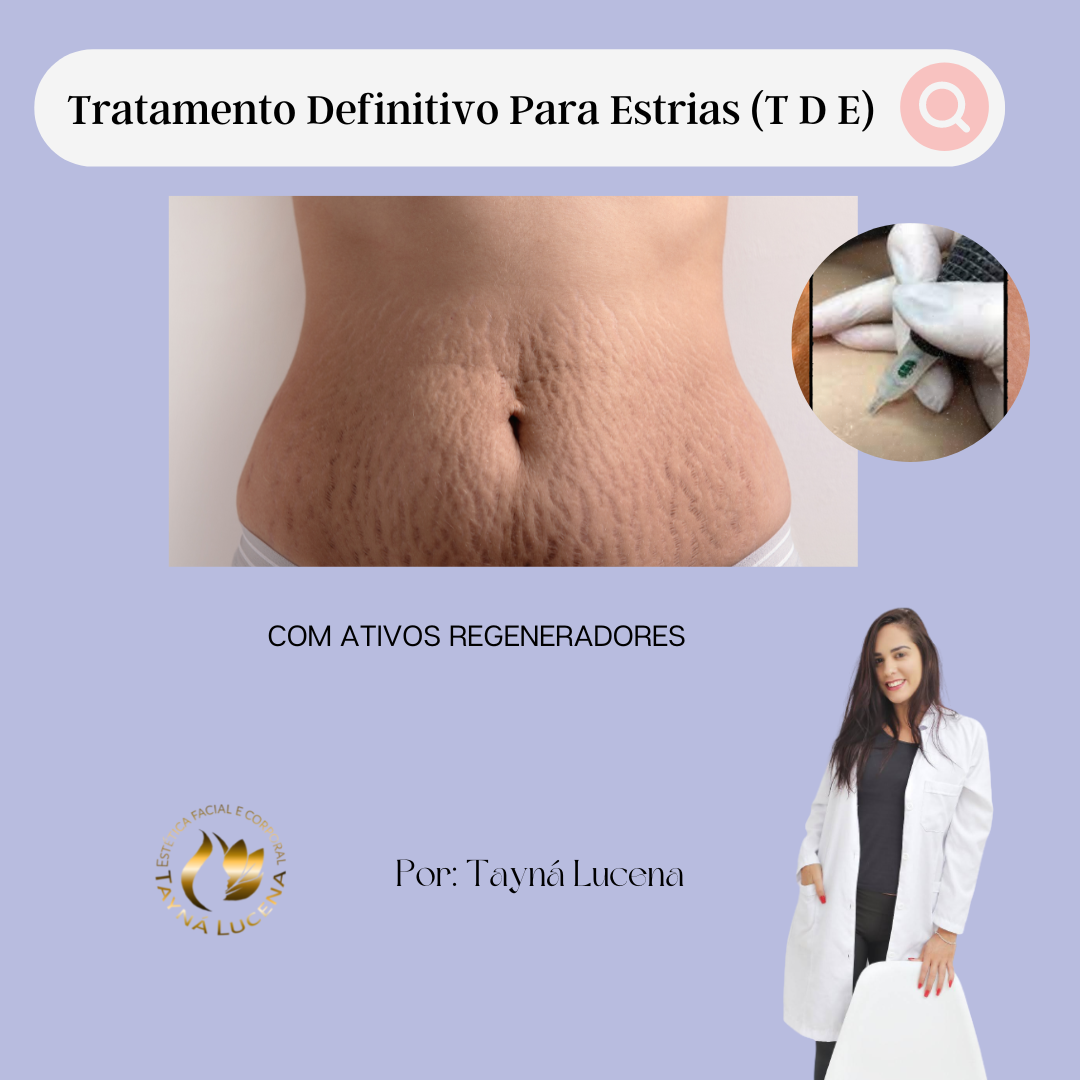 Tratamento Definitivo Para Estrias